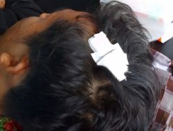 Oknum Polisi Majene Aniaya Pelajar Hingga Alami Luka Robek di Kepala