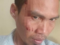 Direktur Perusda Majene Diduga Aniaya Rekan Kerja, Korban Alami Luka Serius Dibagian Kepala