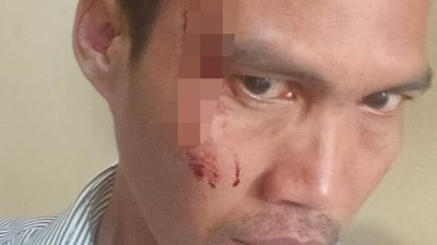 Direktur Perusda Majene Diduga Aniaya Rekan Kerja, Korban Alami Luka Serius Dibagian Kepala